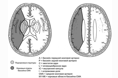 Рисунок 4. Шкала ASPECTS